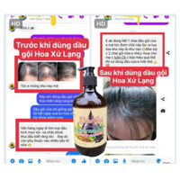 Dầu gội trị rụng tóc, sạch gàu, trị nấm da đầu, nuôi dưỡng tóc chắc khoẻ, suôn mượt