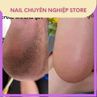 ĐẦU MÀI CHÀ GÓT + MIẾNG DÁN CHÀ GÓT