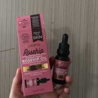 Dầu tầm xuân Rosehip oil hãng Essano