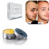 Đề xuất của cô gái nhỏ # Hot bán Norse Organics Acne Skin Repair Moisturizing Moisturizing Skin ws