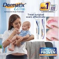 Dermatix Kem Xóa Sạch Sẹo Thâm, lấp đầy Sẹo Rỗ, Sẹo Lõm Scar