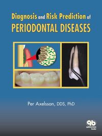 Diagnosis and Risk Prevention of Periodontal Diseases (Axelsson Series on Preventive Dentistry)