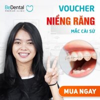 Dịch vụ niềng răng mắc cài sứ