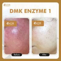 DMK Enzyme 1 - Tái tạo năng lượng, đào thải độc tố qua hệ bạch huyết