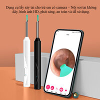Dụng cụ lấy ráy tai cho trẻ em có camera – Nội soi tai không dây, hình ảnh HD, phát sáng, an toàn và dễ sử dụng
