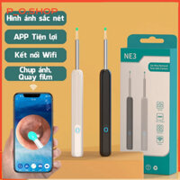 🔥Dụng cụ lấy ráy tai có gắn camera nội soi đa năng hình ảnh sắc nét  -  7