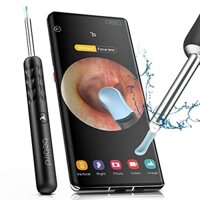 Dụng cụ lấy ráy tai thông minh Xiaomi Bebird R1 / Bebird R3