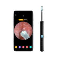 Dụng cụ lấy ráy tai tích hợp camera Bebird R1
