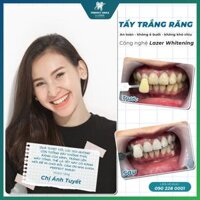 E-voucher Tẩy trắng răng công nghệ Laser Whitening