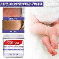 Eelhoe Baby Hip Care Cream Repair Redness Anti Ngứa Nappy Rash Eczema Acne Bed Sores