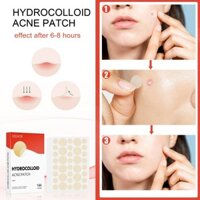 Eelhoe Hydrocolloid Acne Pimple Miếng Dán 144 Cái Điều Trị Vết Bẩn Chống Thấm Nước Loại Bỏ Mụn Miếng Dán
