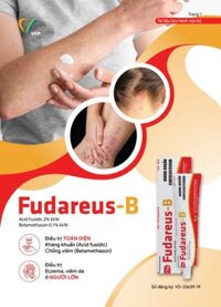 FUDAREUS B VCP Cream 15g điều trị chàm dị ứng, eczema, vảy nến (thay Fucicort)