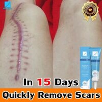 Gel xóa sẹo KELO COTE