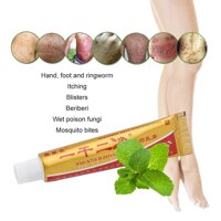 GETEK Yiganerjing Psoriasis Eczema Ointment Body Cream Suitable All Skin Diseases