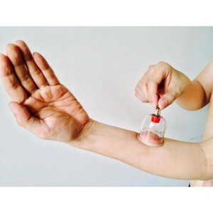 Giác hơi không dùng lửa Duy Thành YGH05