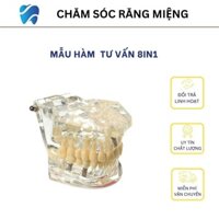 Hàm tư vấn 8 in 1 đủ các bệnh lý dùng trong nha khoa