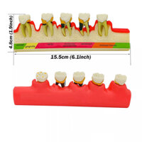 Hàm tư vấn bệnh lý nha chu