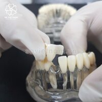 Hàm tư vấn bệnh lý nha khoa 5in1