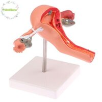 Hdmeliana 1 Cái Đạo Cụ Y Tế Mô Hình Bệnh Lý Uterus Ovary Mô Hình Giải Phẫu Phần Chữ Thập Dụng Cụ Học VN