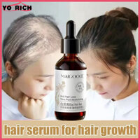 [Hiệu quả nhanh] Serum tăng trưởng tóc Gừng Thuốc bổ tóc 60ML Tăng trưởng tóc cho nam và nữ Chống rụng tóc Ngăn ngừa mọc tóc Bổ sung tóc Chiết xuất thực vật tự nhiên