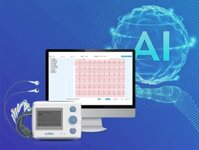 Holter Điện Tim 12 Kênh Phân Tích AI