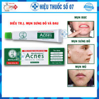 Kem Acnes Medical Cream ngăn ngừa mụn, giảm sưng, tái tạo da tuýp 18g