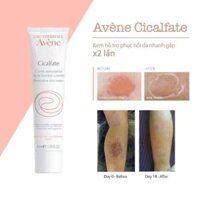 Kem Avene Cicalfate cream 40ml