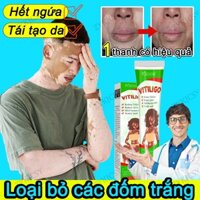 Kem bôi bạch biến Lấy lại sự tự tin Từ trắng sang đen thuốc bôi nấm ngứa kem bôi kem bôi da hắc lào