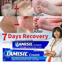 KEm bôi da chân cho vận động viên Đức(15gam) Athlete's Foot