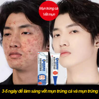 kem bôi sạch mụn gel bôi xóa mụn Giảm mụn mờ vết thâm Loại bỏ mụn cứng đầu và ngăn ngừa tái phát
