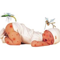 KEM BÔI TRỊ MUỖI VÀ CÔN TRÙNG ĐỐT MUHI S 15GR
