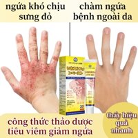 kem bôi ức chế vi khuẩn Xóa mụn lưng kem bôi xóa mụn kem bôi mụn kem chấm mụn loại bỏ Da gà Kem lưu huỳnh loại bỏ bọ ve