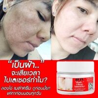 Kem Bong Nám Tái Tạo Da BEZY đẹp da sau 7 ngày