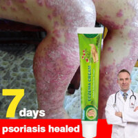 Kem chàm Kem trị bệnh vẩy nến Nhiễm nấm ngứa Da chàm Kem chống ngứa Điều trị bệnh chàm Kem chống nấm ngứa