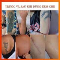 kem che hình xăm ziptato