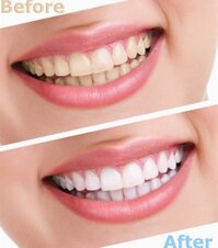 Kem đánh răng Arm & Hammer Advance White Extreme.baking soda & peroxide 120ml canada