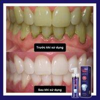 Kem đánh răng Làm trắng răng thơm miệng 150g/chai tẩy vết thuốc lá làm trắng răng Giúp giảm độ nhạy hôi miệng