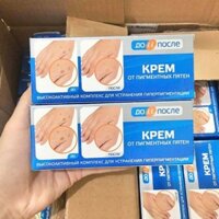 Kem đồi mồi tay chân Kpem Nga