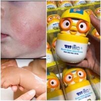 KEM DƯỠNG ẨM CHO BÉ POPORO