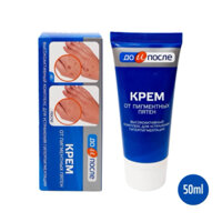 Kem Dưỡng Giảm Đồi Mồi Da Tay KpeM Nga 50ml