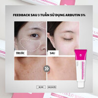 Kem dưỡng trắng Arbutin 5% Tosowoong 50ml