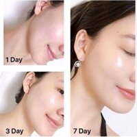 Kem Dưỡng Trắng Da mặt, Chống Lão Hóa OLAY Total Effects 7 in 1 Ban Ngày & Đêm 50ml (UK)