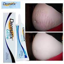 Kem hỗ trợ trị sẹo Dermatix 15g