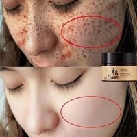 Kem làm trắng tàn nhang kem xóa nám hiệu quả loại bỏ vết nám làm mờ tàn nhang có giảm vết thâm làm trắng nhanh chóng30g