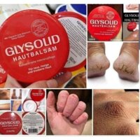 Kem Nẻ Glysolid Hautbalsam của Đức - KOLA Việt Nam