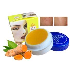 Kem nghệ trị mụn thâm Q’Care White