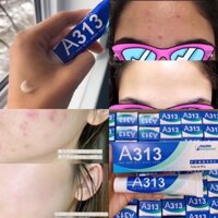 kem Retinol chống lão hoá A313