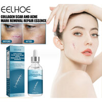 Kem sẹo phẫu thuật - Gel bôi sẹo lồi lõm lâu năm Scar giảm rạn hiệu quả 20ml