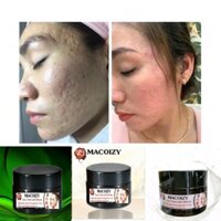 KEM SẸO RỖ SẸO MỤN SẸO THÂM TRẮNG DA