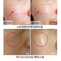 Kem siêu trắng da SILKY WHITE CREAM bản mới Premium JUKIMI Nhật 30gr